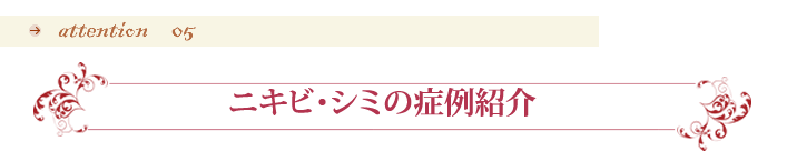 ニキビ・シミの症例紹介