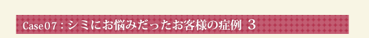 Case07：シミにお悩みだったお客様の症例 3