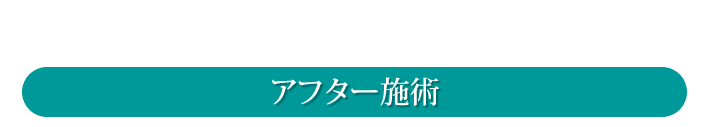 シミができる原因